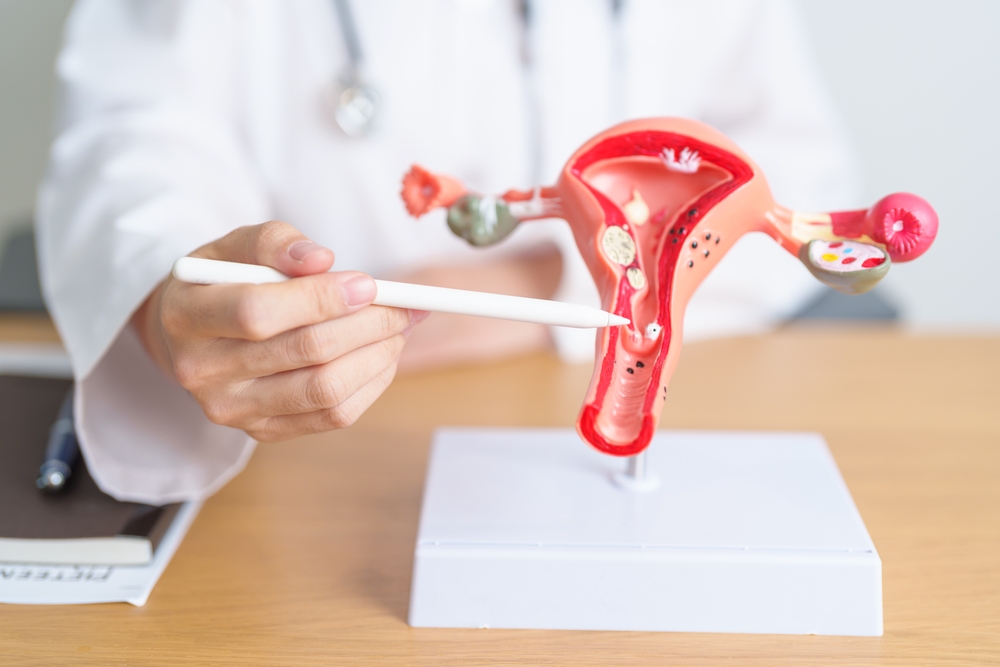 Doctor with Uterus and Ovaries anatomy model.